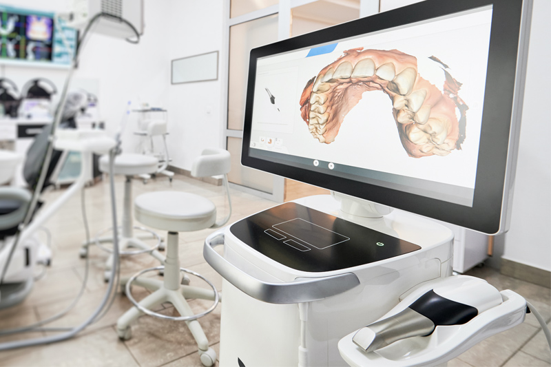 Intra-Oral Scanner in Bakersfield
